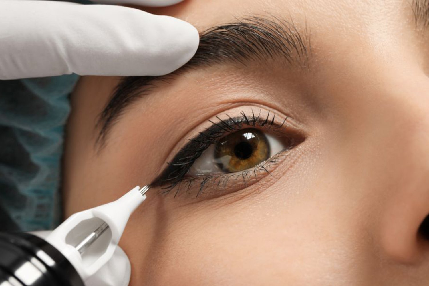 Cosmetic tattooing